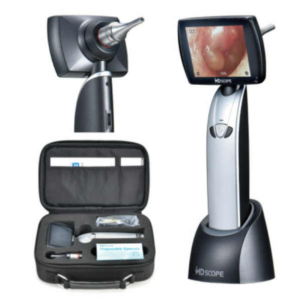 Video Otoscope - Omega